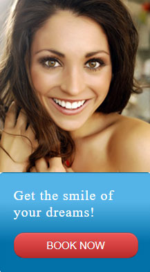 Megawhite Express Teeth Whitening - Dream Smile