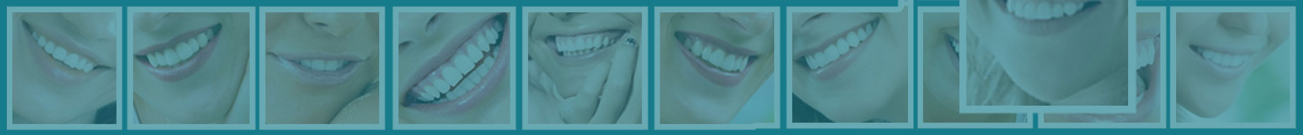 Megawhite Express Teeth Whitening - About Us